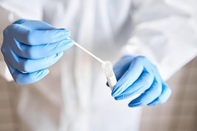 Coronavirus COVID-19 Test